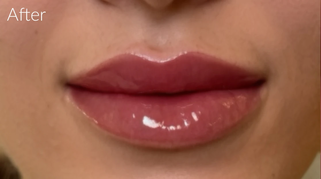 Lip Blush Services Caulfield After Result