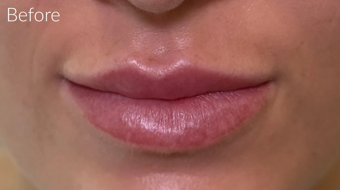 Lip Blush Services Caulfield Before Result